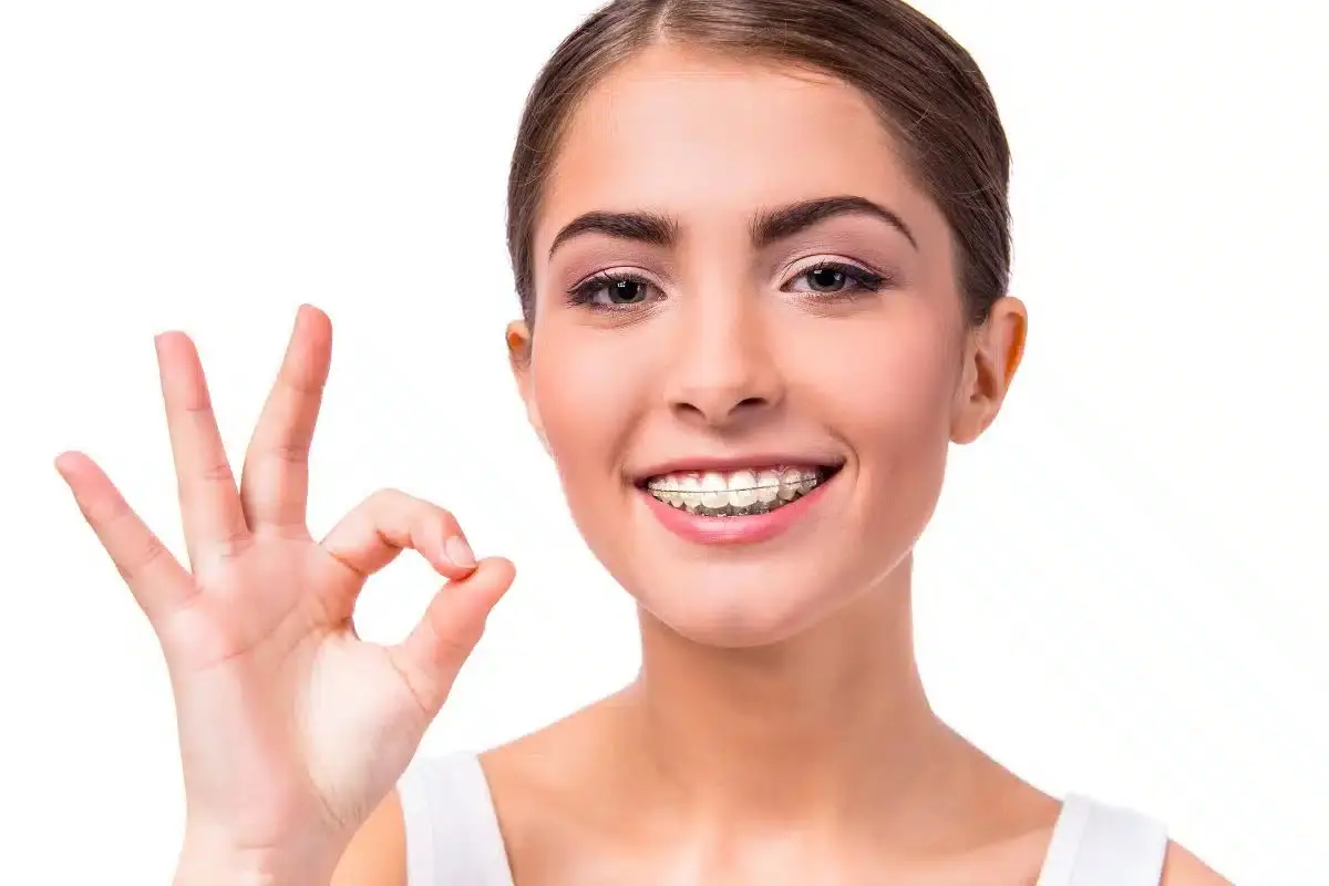 Close-up of lingual braces placed on the back of a patient’s teeth for an invisible orthodontic solution