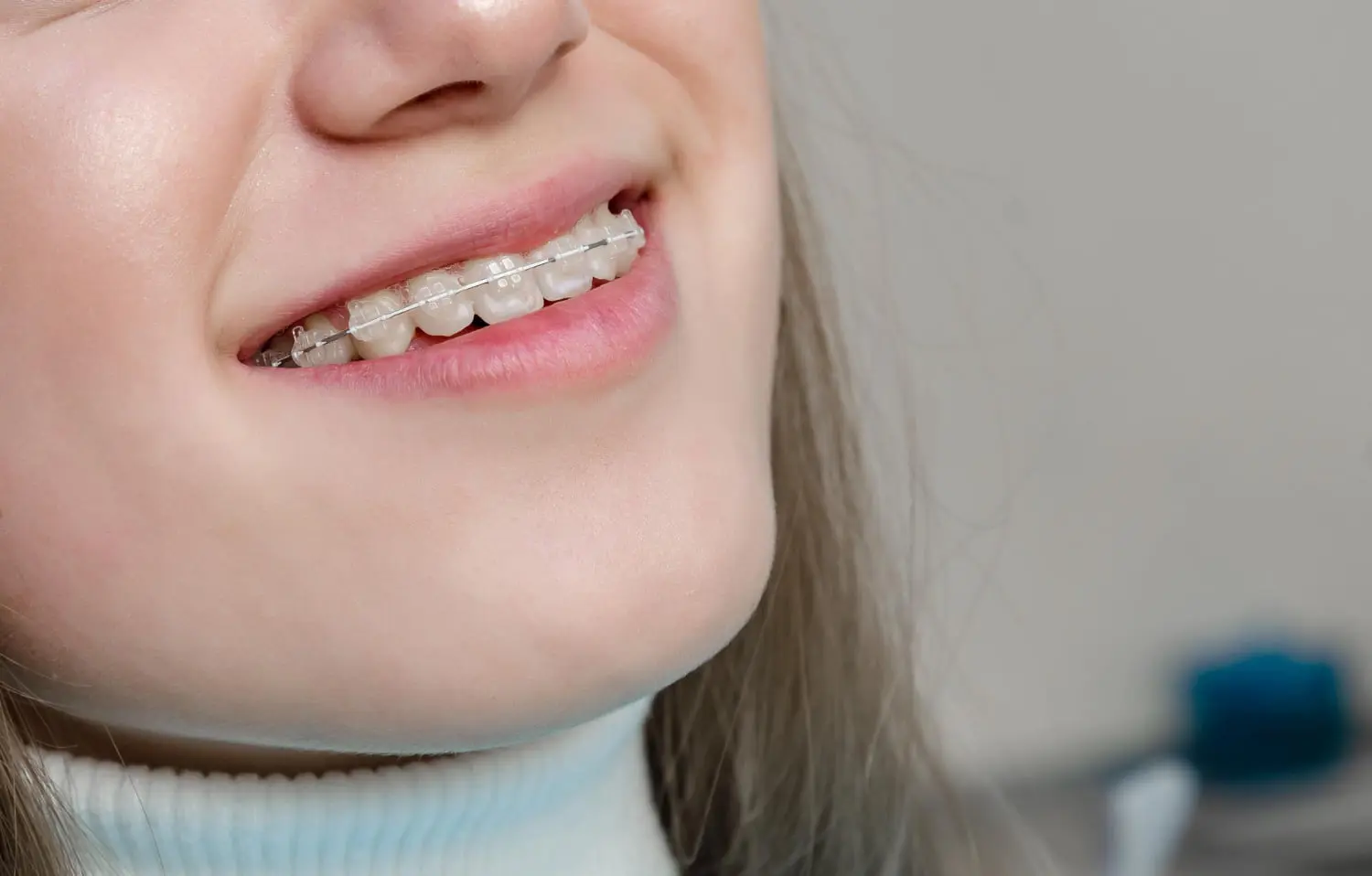 Close-up of a person smiling, proudly displaying their clear braces, courtesy of Best Orthodontics.