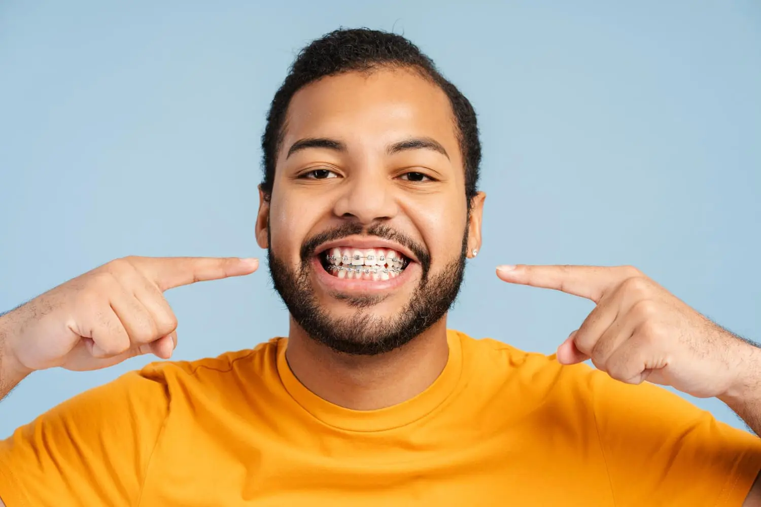 Wearing a yellow shirt against a vibrant blue background, the person beams with confidence, proudly pointing at their braces. Their smile is a testament to the superior care they've received from Best Orthodontics.